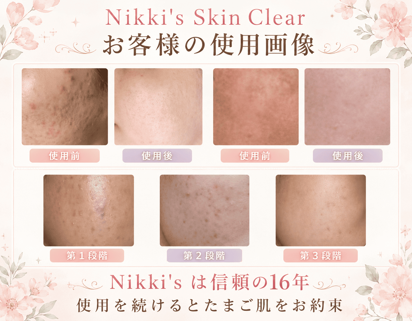 ニッキーズスキンクリア 使用者様使用例3
