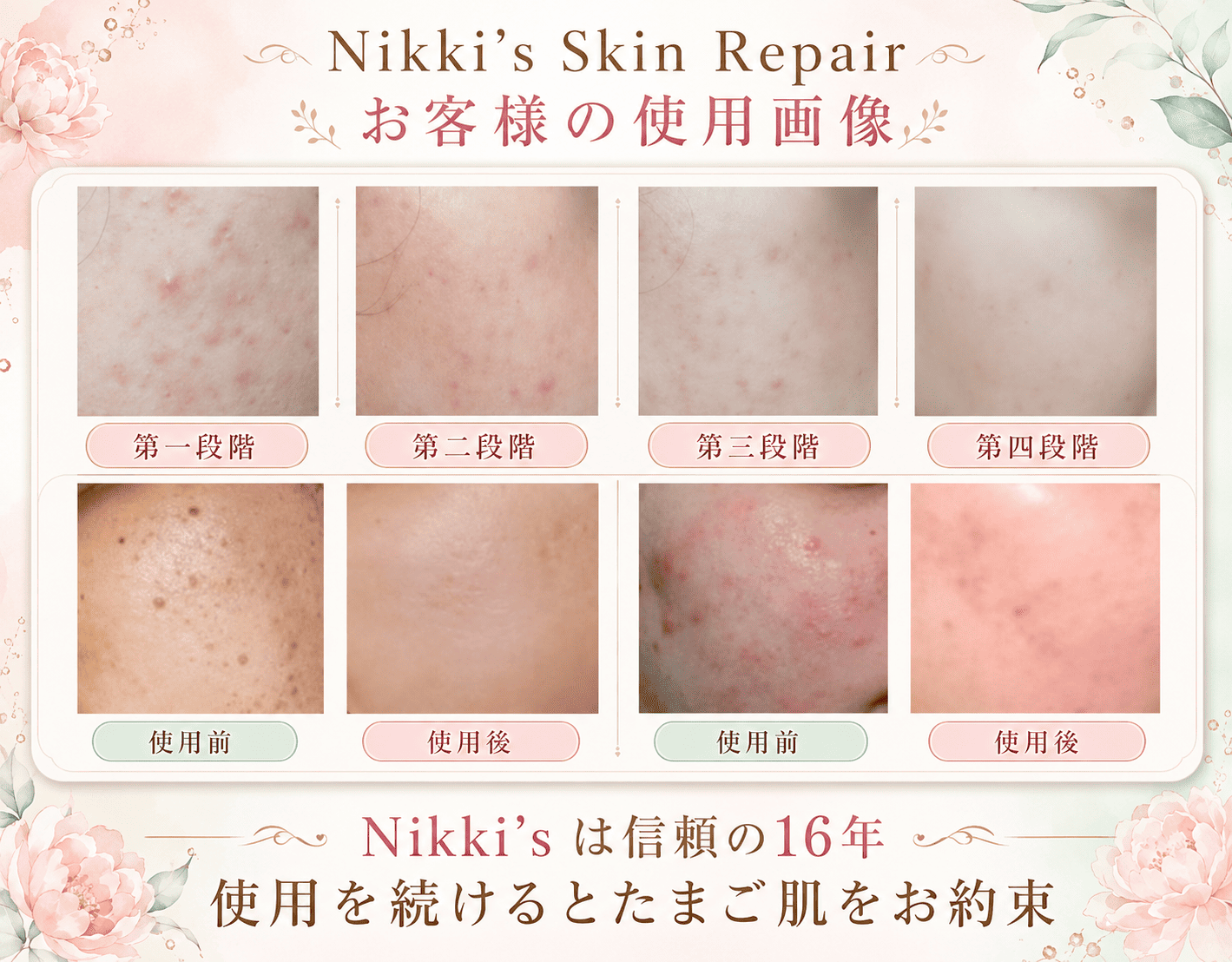 Nikki's Skin Repair お客様の使用画像1