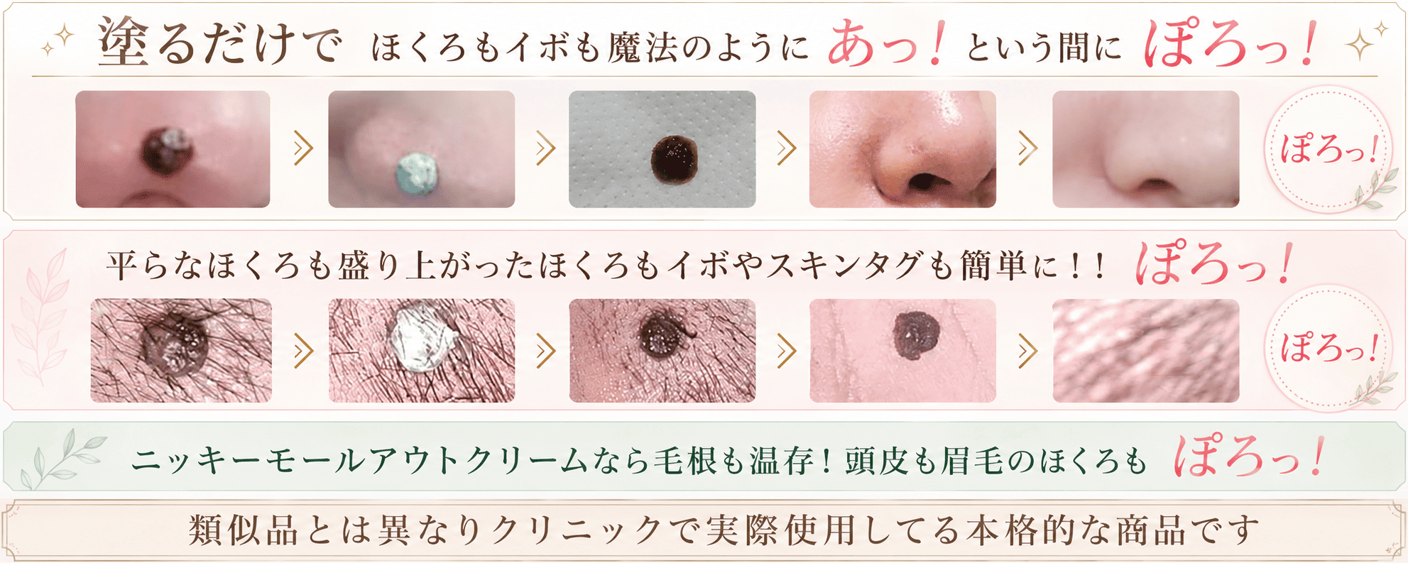 ニッキーモールアウトクリームなら厳選されたハーブ成分の力でほくろがぽろっと取れます